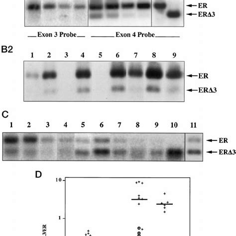 Analysis Of Er ␣ And Er ␣ ⌬ 3 Mrna Expression In Normal Breast And