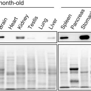 Tissue distribution of Glipr1. Upper panels show the tissue ... 
