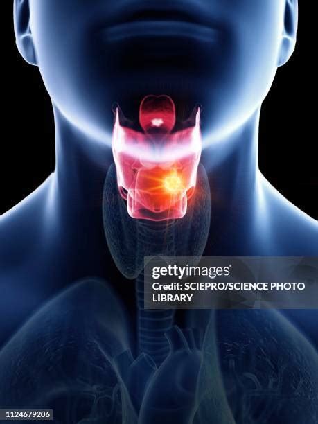 217 Epiglottis High Res Illustrations - Getty Images