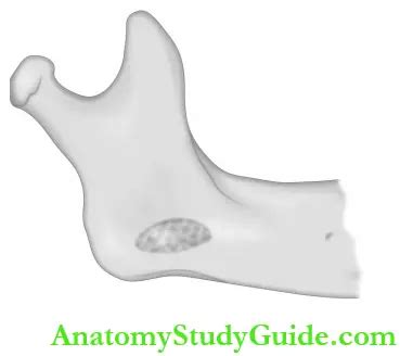 Ameloblastoma Radiology and Ameloblastoma Treatment - Anatomy Study Guide