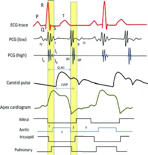 Carotid Pulse