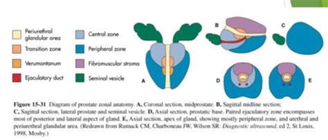 Normal Prostate Flashcards Quizlet