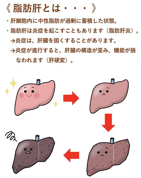 肝臓の疾患 にしだ 内科・外科クリニック