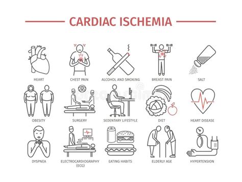 Baner F R Myocardial Infarkt Symbol Tecken Behandling Vektortecken