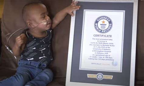 Bebê apenas 21 semanas de vida entra no Guinness Book como o mais