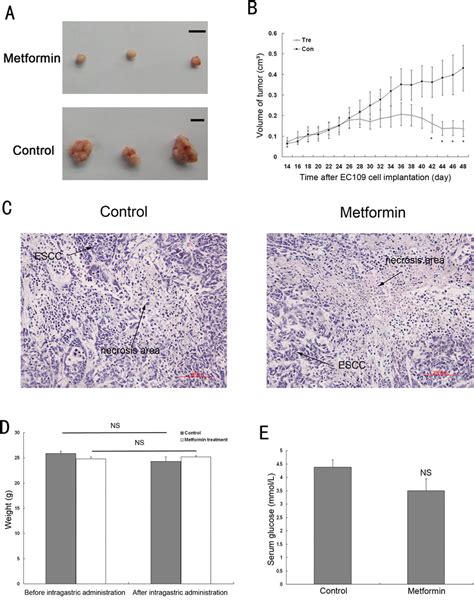 Metformin Inhibited The Growth Of Ec Cell Xenografts In Nude