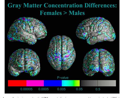 Figure 1 From Mapping Cortical Gray Matter In The Young Adult Brain