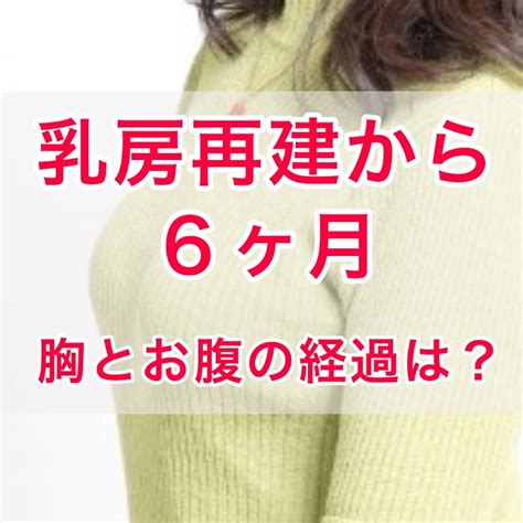 B 健康 乳がんで乳房全的手術から6ヶ月～半年間の体の変化＆乳頭再建の予定が決まりました さくさくの日常