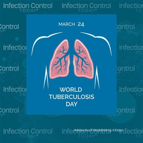 Ict Observes World Tuberculosis Day 2024 Yes We Can End Tb