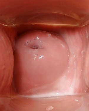 Cervix Porn Pics PICTOA