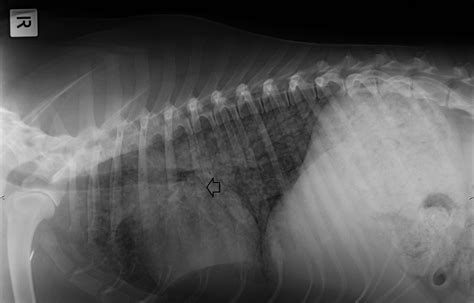 Toxoplasmosis As A Cause Of Life‐threatening Respiratory Distress In A