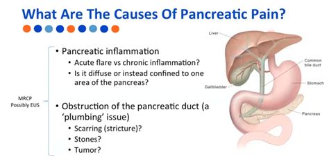 Pancreas Pain Location