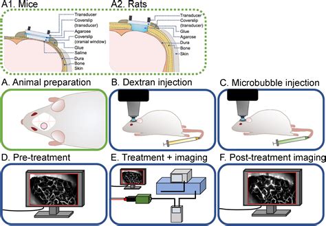 Real Time Intravital Multiphoton Microscopy To Visualize Focused Ultrasound And Microbubble