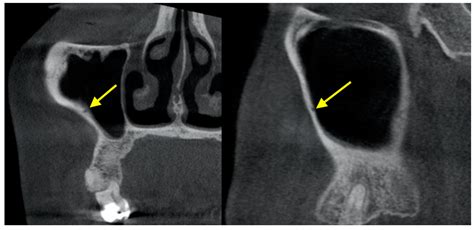 Diagnostics Free Full Text The Use Of Cbct In Evaluating The Health