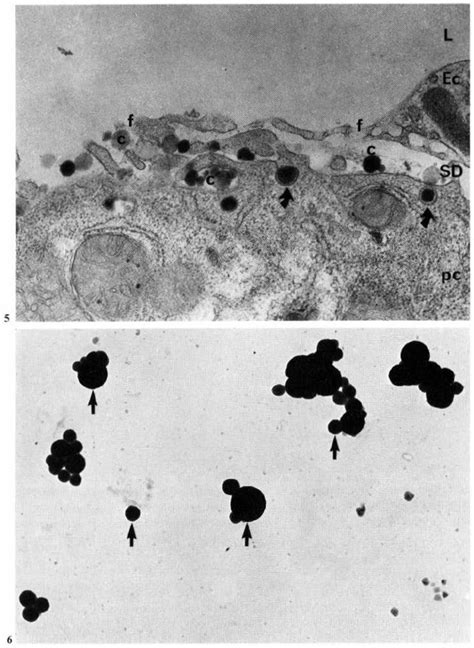 Pinocytosis Of Chylomicrons By Parenchymal Cells Arrows X 299000 Download Scientific Diagram