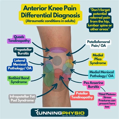 Knee Pain Differential Diagnosis