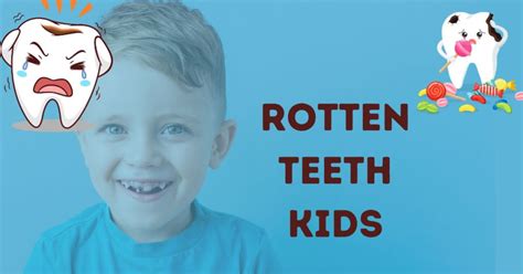 Rotten Teeth Kids: Everything About Tooth Decay in Kids