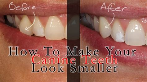 How To Sharpen Your Canine Teeth New Update Abettes Culinary