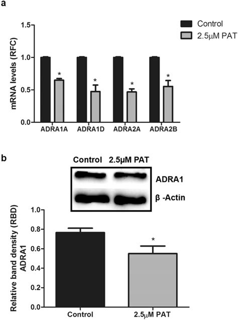 PAT alters α adrenergic receptor expression at both transcriptional and