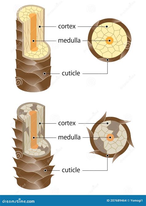 Layer Of Healthy And Damaged Hair Structure The Hair Shaft Consists Of