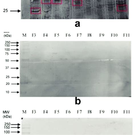 Western Blot Analysis On Entamoeba Histolytica Membrane Proteins