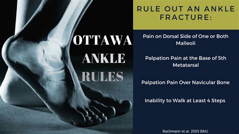 Make Sure Youre Up To Date On The New Clinical Guidelines For Ankle