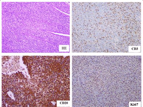 Hematoxylin Eosin He Staining And Immunohistochemistry Were Carried