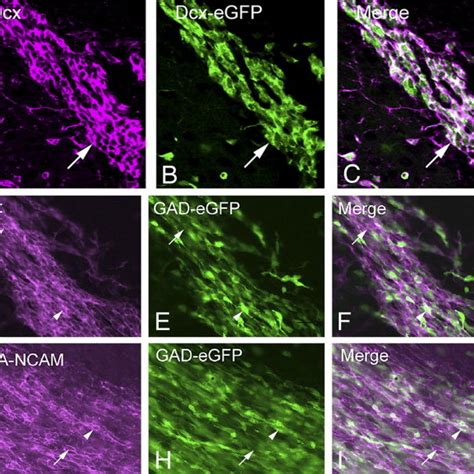 Dcx Egfp And Gad Egfp Labeled Svz Neuroblasts Ac Dcx Download