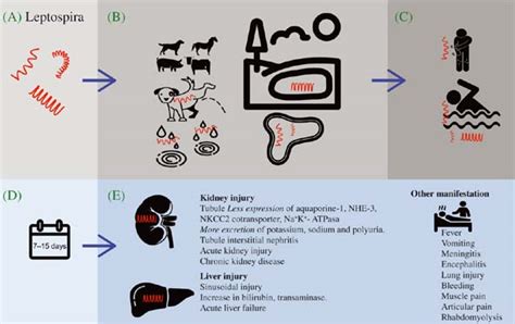 Acute Kidney Injury And Acute Liver Failure In Leptospira Infection And