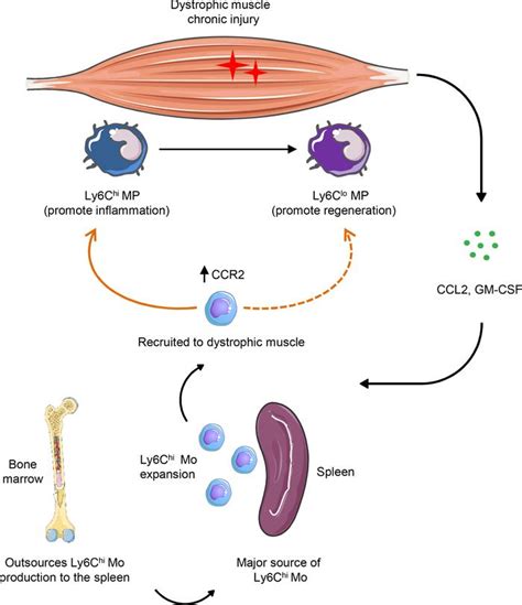 JCI Insight Splenic Ly6Chi Monocytes Are Critical Players In