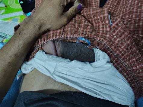 Me My Cock 2 Nude Pics XHamster