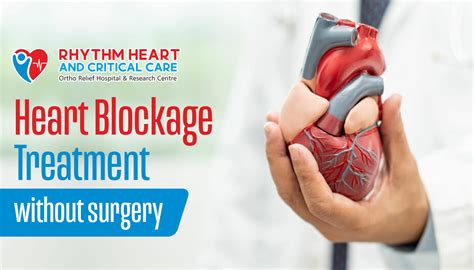 Heart Blockage Treatment Without Surgery A Comprehensive Guide