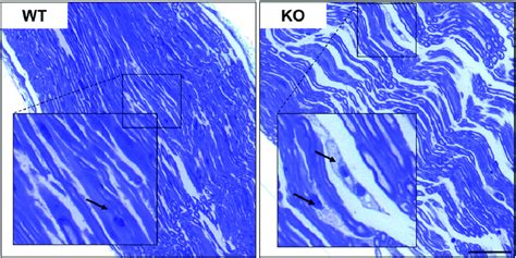 Cytoplasmic Vacuolization But Normal Myelination In The PNS Of