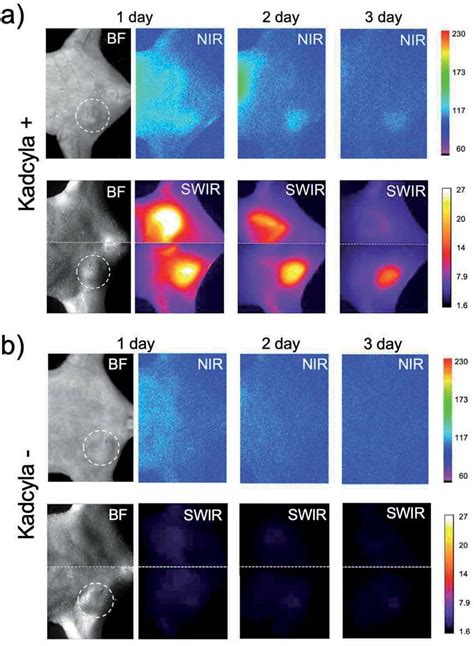 Bright Filed Bf And Nir Swir Fluorescence Imaging Of Breasttumor