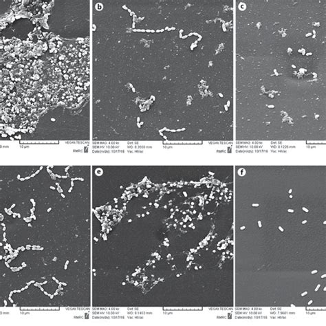 Scanning Electron Micrographs A Micrograph Of An Untreated Urinary