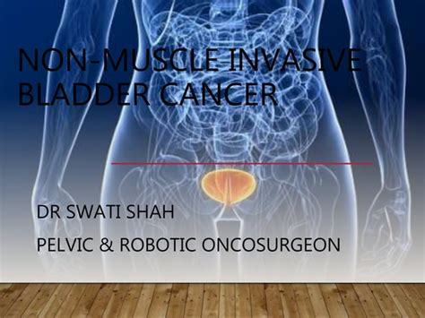 Non Muscle Invasive Bladder Cancer PPT