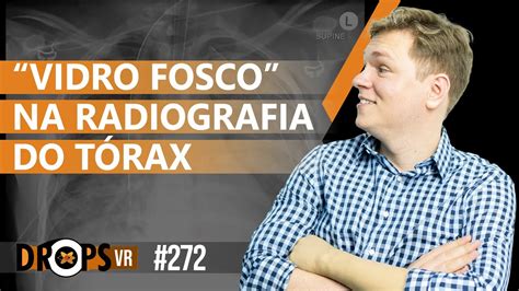 VIDRO FOSCO NA RADIOGRAFIA DO TÓRAX O QUE PODE SER YouTube