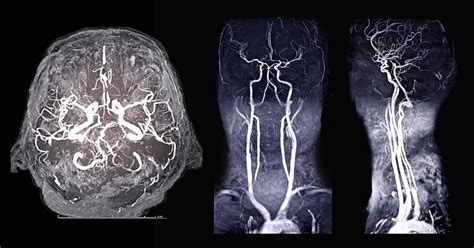 Understanding MRI Contrast: How It Works | by MRIPETCTSOURCE | May, 2023 | Medium