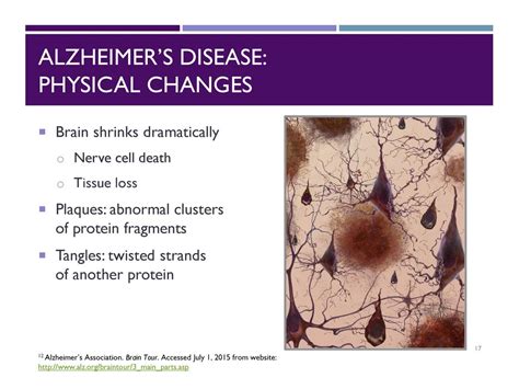 A Public Health Approach To Alzheimers And Other Dementias Ppt Download