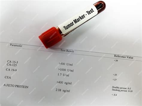 premium photo blood sample  cancer marker test  tumor marker
