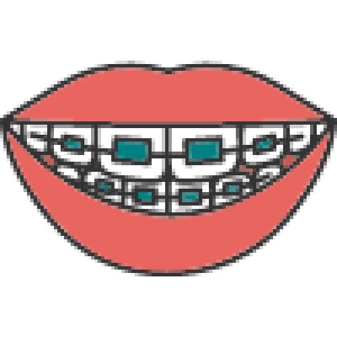 Teal Braces Color: Are They Good Fit? | Ultimate 2025 Guide