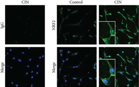 Activation Of The NRF2 HMOX1 And NQO 1 Pathway By Cinnamaldehyde A