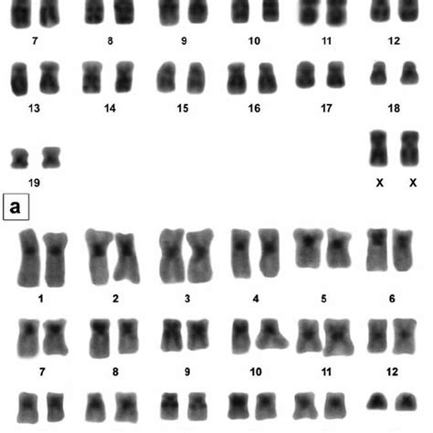 A G Banded Karyotype Of A Female And B C Banded Karyotype Of A Male