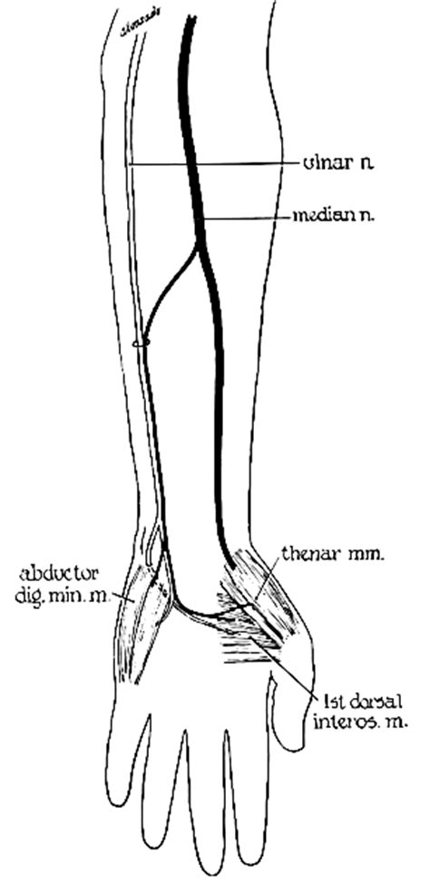 Variations In The Innervation Of Upper And Lower Extremities Teleemg