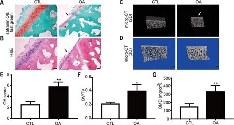 Histological And Microstructural Changes In The Subchondral Bone Of The