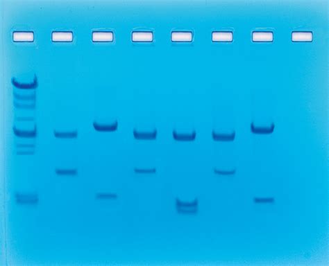 Dna Fingerprinting Using Restriction Enzymes Biotek