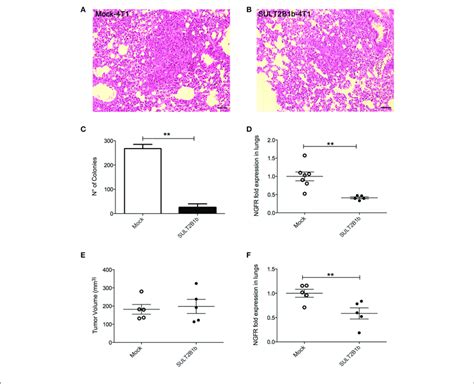 Sult2b1b Expression Affects In Vivo Metastatic Behaviour Of 4t1 Tumor