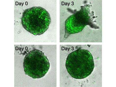 Researchers Identify Molecular Mechanism Of Cancer Invasion