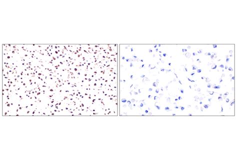 Galectin 8 LGALS8 F9O3T Rabbit MAb Cell Signaling Technology