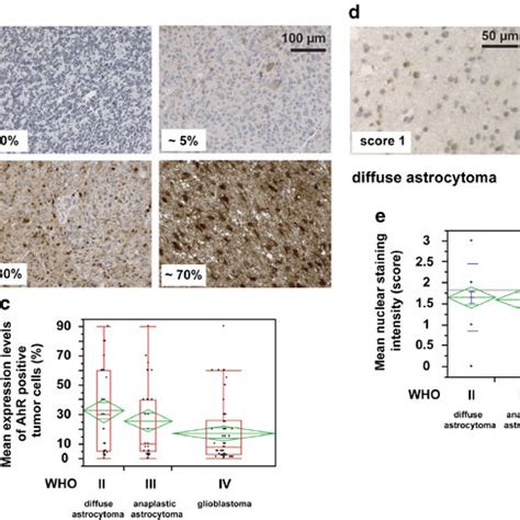 Human Malignant Glioma Cells Express Aryl Hydrocarbon Receptor Ahr In